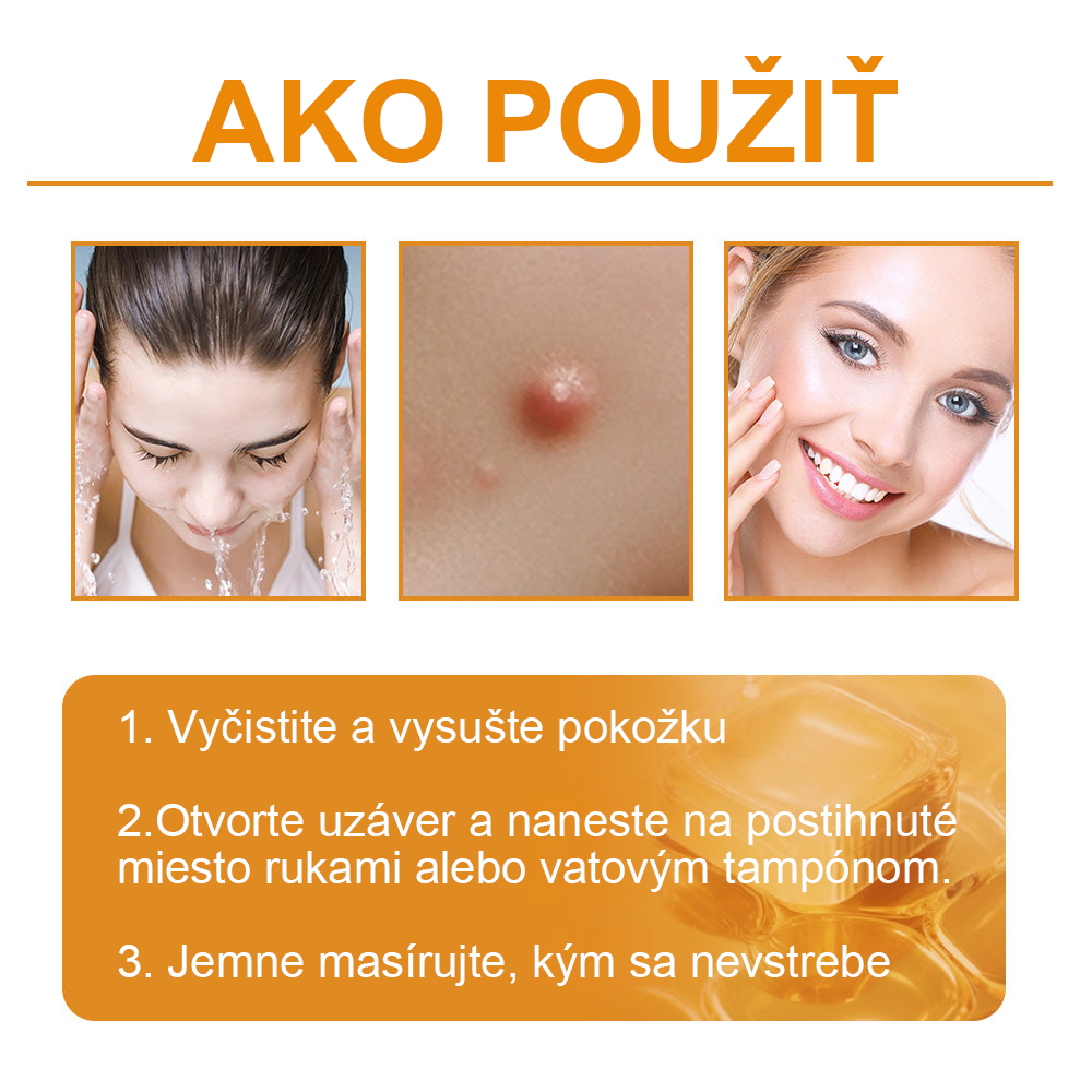 🧄𝑉𝑠𝑜𝑥𝑎™Velim Jędom Odsłanenij Bradavič Krém Znamionok (🧑‍⚕️AAD odporúča)🐝🐝(🔥Akcia na posledný deň - 80% zľava💒)🥔