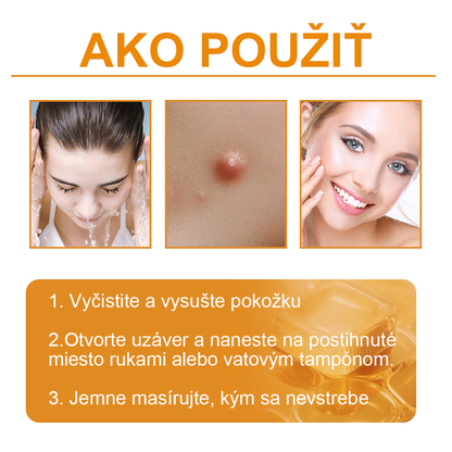 🧄𝑉𝑠𝑜𝑥𝑎™Velim Jędom Odsłanenij Bradavič Krém Znamionok (🧑‍⚕️AAD odporúča)🐝🐝(🔥Akcia na posledný deň - 80% zľava💒)🥔