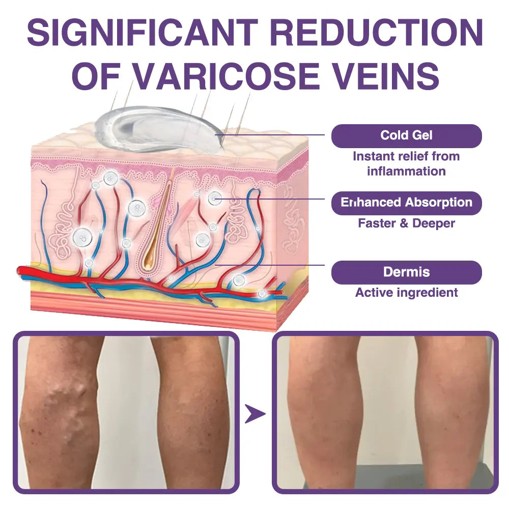 𝐎𝐮𝐫𝐥𝐲𝐚𝐫𝐝® 𝐅𝐞𝐞𝐋𝐞𝐠 𝐂𝐚𝐫𝐞 𝐏𝐡𝐲𝐭𝐨 𝐆𝐞𝐥