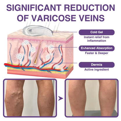 𝐎𝐮𝐫𝐥𝐲𝐚𝐫𝐝® 𝐅𝐞𝐞𝐋𝐞𝐠 𝐂𝐚𝐫𝐞 𝐏𝐡𝐲𝐭𝐨 𝐆𝐞𝐥