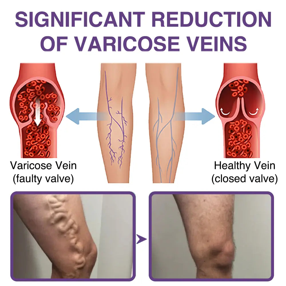 𝐎𝐮𝐫𝐥𝐲𝐚𝐫𝐝® 𝐅𝐞𝐞𝐋𝐞𝐠 𝐂𝐚𝐫𝐞 𝐏𝐡𝐲𝐭𝐨 𝐆𝐞𝐥