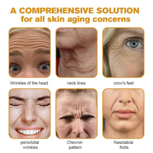 👨‍⚕️ Hergestellt und versendet in den USA ✅ Botox-Bienengift-Faltenentfernungscreme – LETZTER TAG 80 % RABATT