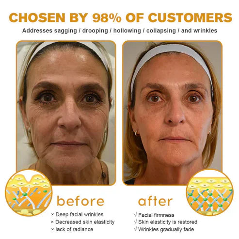 👨‍⚕️ Hergestellt und versendet in den USA ✅ Botox-Bienengift-Faltenentfernungscreme – LETZTER TAG 80 % RABATT