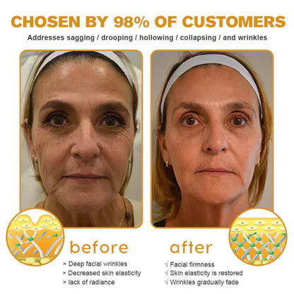 👨‍⚕️ Hergestellt und versendet in den USA ✅ Botox-Bienengift-Faltenentfernungscreme – LETZTER TAG 80 % RABATT