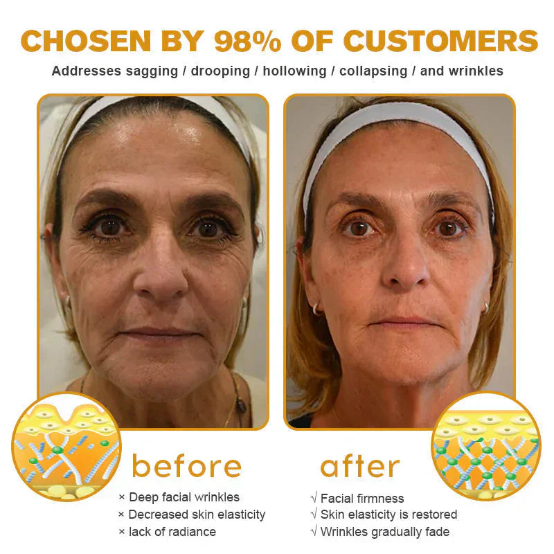 👨‍⚕️ Hergestellt und versendet in den DE ✅ Botox-Bienengift-Faltenentfernungscreme – LETZTER TAG 80 % RABATT