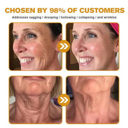 👨‍⚕️ Hergestellt und versendet in den USA ✅ Botox-Bienengift-Faltenentfernungscreme – LETZTER TAG 80 % RABATT