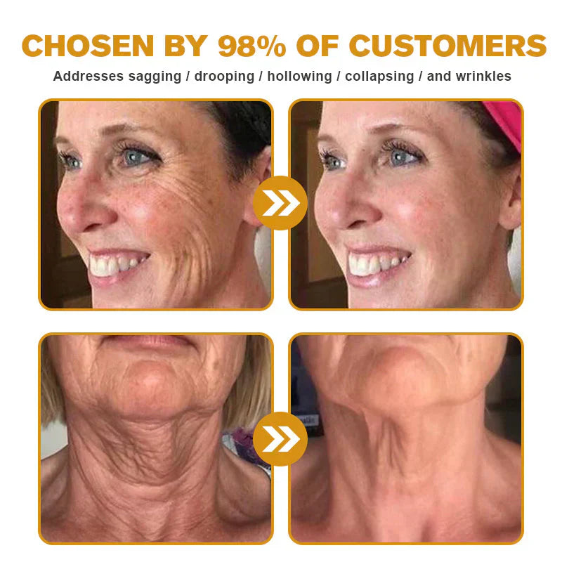 👨‍⚕️ Hergestellt und versendet in den DE ✅ Botox-Bienengift-Faltenentfernungscreme – LETZTER TAG 80 % RABATT