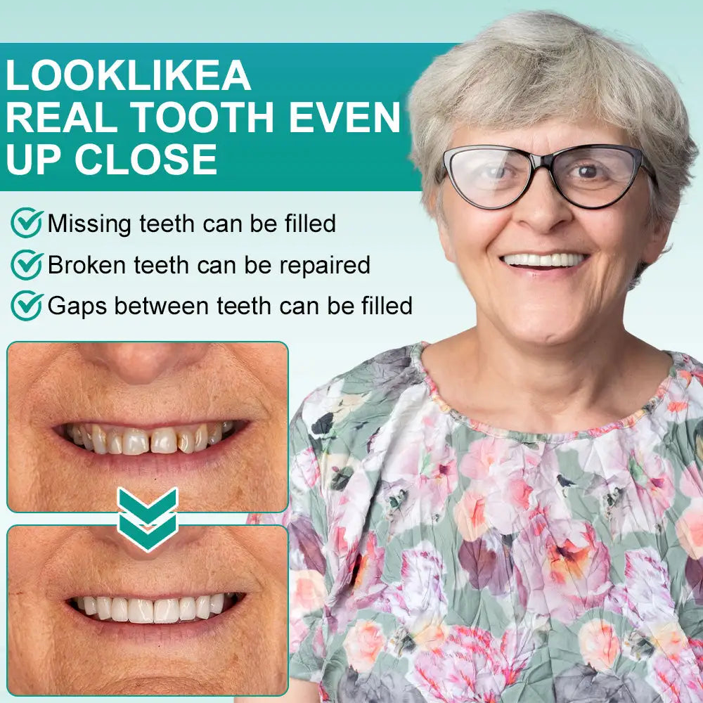 𝗢𝘂𝗿𝗹𝘆𝗮𝗿𝗱® 𝗜𝗻𝘀𝘁𝗮𝗻𝘁 𝗦𝘁𝗶𝗰𝗸-𝗼𝗻 𝗗𝗲𝗻𝘁𝗮𝗹 𝗩𝗲𝗻𝗲𝗲𝗿𝘀
