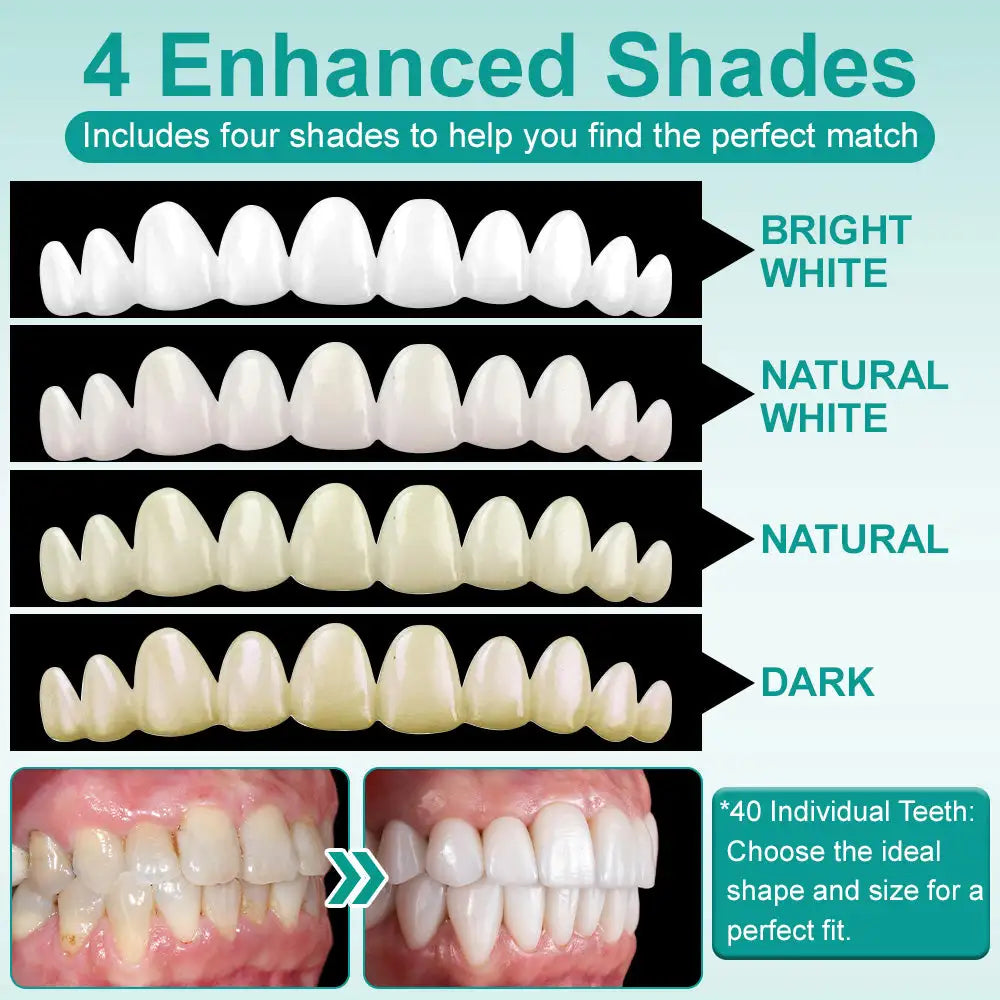 𝗢𝘂𝗿𝗹𝘆𝗮𝗿𝗱® 𝗜𝗻𝘀𝘁𝗮𝗻𝘁 𝗦𝘁𝗶𝗰𝗸-𝗼𝗻 𝗗𝗲𝗻𝘁𝗮𝗹 𝗩𝗲𝗻𝗲𝗲𝗿𝘀