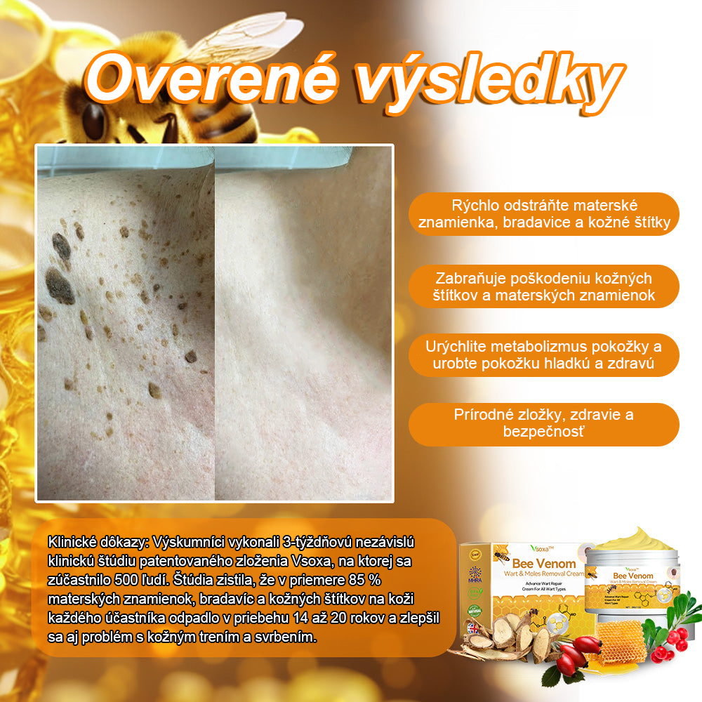 🧄𝑉𝑠𝑜𝑥𝑎™Velim Jędom Odsłanenij Bradavič Krém Znamionok (🧑‍⚕️AAD odporúča)🐝🐝(🔥Akcia na posledný deň - 80% zľava💒)🥔