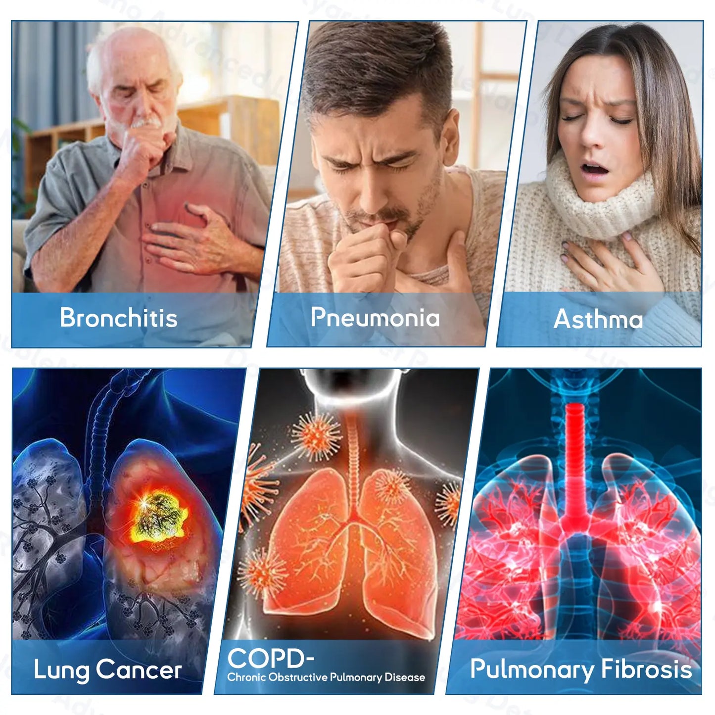 𝐎𝐮𝐫𝐥𝐲𝐚𝐫𝐝® 𝐃𝐨𝐮𝐛𝐥𝐞𝐍𝐚𝐧𝐨 𝐀𝐝𝐯𝐚𝐧𝐜𝐞𝐝 𝐋𝐮𝐧𝐠 𝐃𝐞𝐭𝐨𝐱 𝐑𝐞𝐥𝐢𝐞𝐟 𝐏𝐚𝐭𝐜𝐡