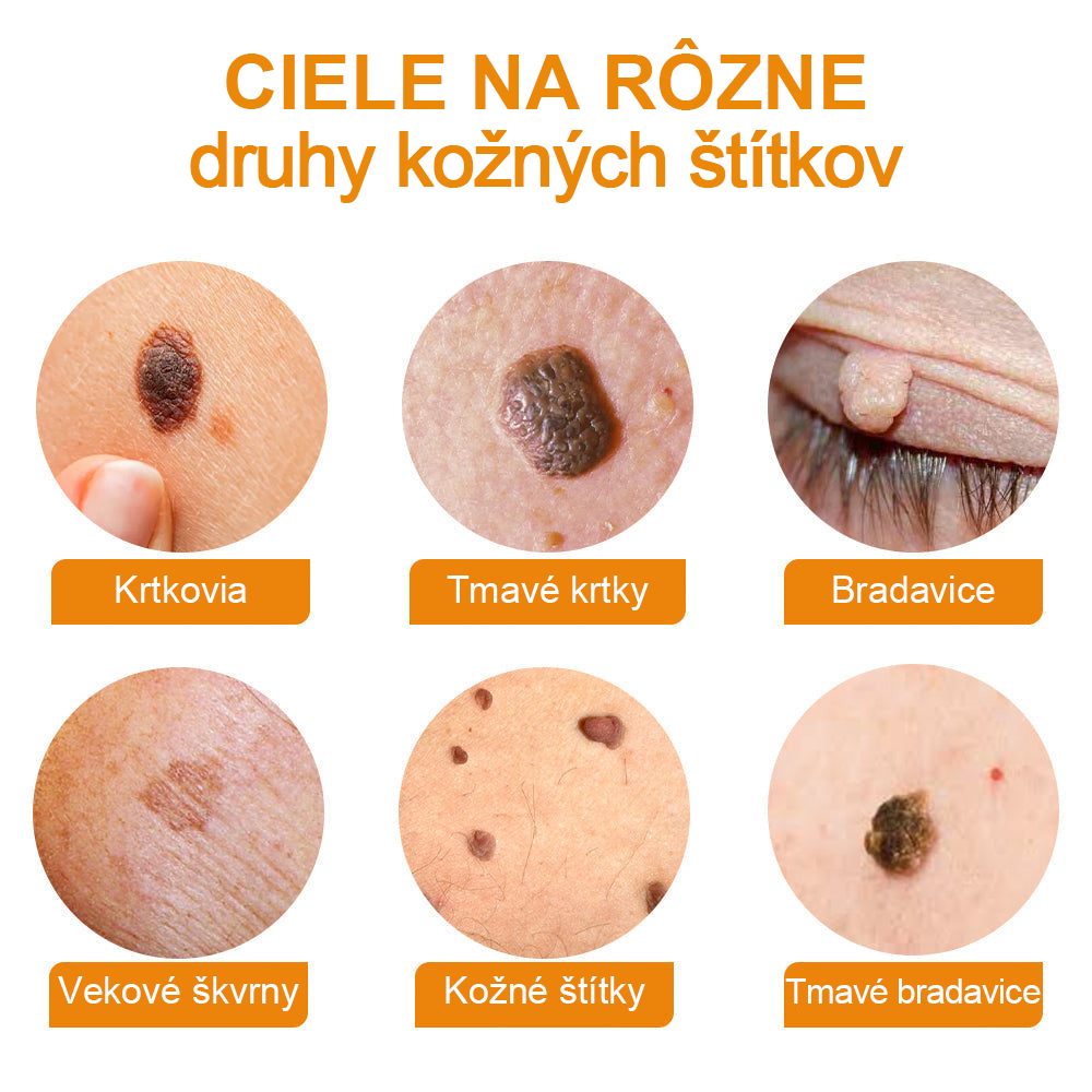🧄𝑉𝑠𝑜𝑥𝑎™Velim Jędom Odsłanenij Bradavič Krém Znamionok (🧑‍⚕️AAD odporúča)🐝🐝(🔥Akcia na posledný deň - 80% zľava💒)🥔