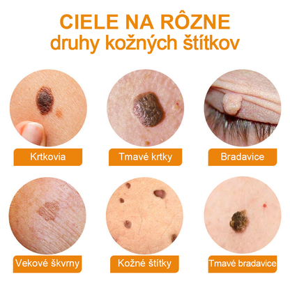 🧄𝑉𝑠𝑜𝑥𝑎™Velim Jędom Odsłanenij Bradavič Krém Znamionok (🧑‍⚕️AAD odporúča)🐝🐝(🔥Akcia na posledný deň - 80% zľava💒)🥔