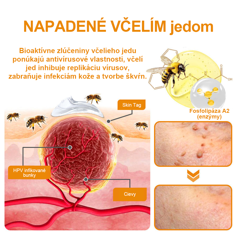 🧄𝑉𝑠𝑜𝑥𝑎™Velim Jędom Odsłanenij Bradavič Krém Znamionok (🧑‍⚕️AAD odporúča)🐝🐝(🔥Akcia na posledný deň - 80% zľava💒)🥔
