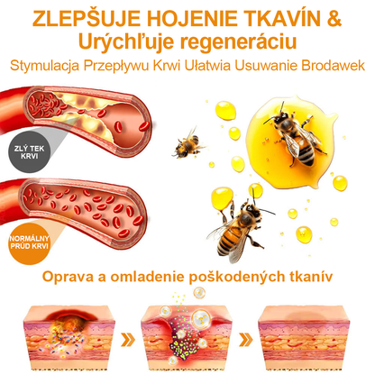 🧄𝑉𝑠𝑜𝑥𝑎™Velim Jędom Odsłanenij Bradavič Krém Znamionok (🧑‍⚕️AAD odporúča)🐝🐝(🔥Akcia na posledný deň - 80% zľava💒)🥔
