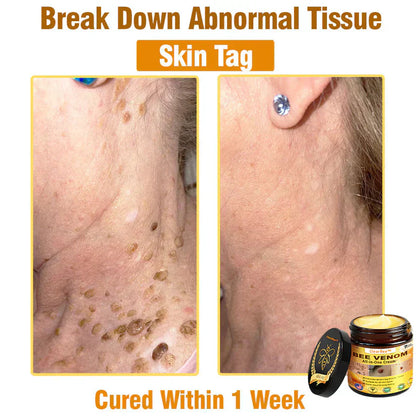 🔥FDA Approved:  Bee Venom Skin Restoration Cream — 🔥Limited Time 80% OFF🔥