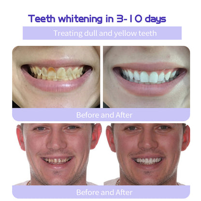 🔥Ends Tonight: Get 60% OFF Before It’s Gone!🎁 Fluoride-Free Hydroxyapatite Toothpaste – Gentle Whitening & Enamel Strength for Sensitive Teeth