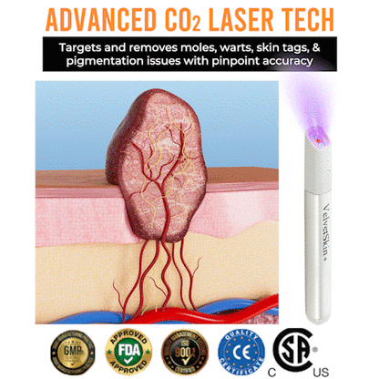 🛡️WishTint® VelvetSkin+ Integrated laser eraser ⚔︎(⚡powered by CO₂ laser technology - effectively removes moles, warts, skin labels, pigmentation spots and other skin defects)