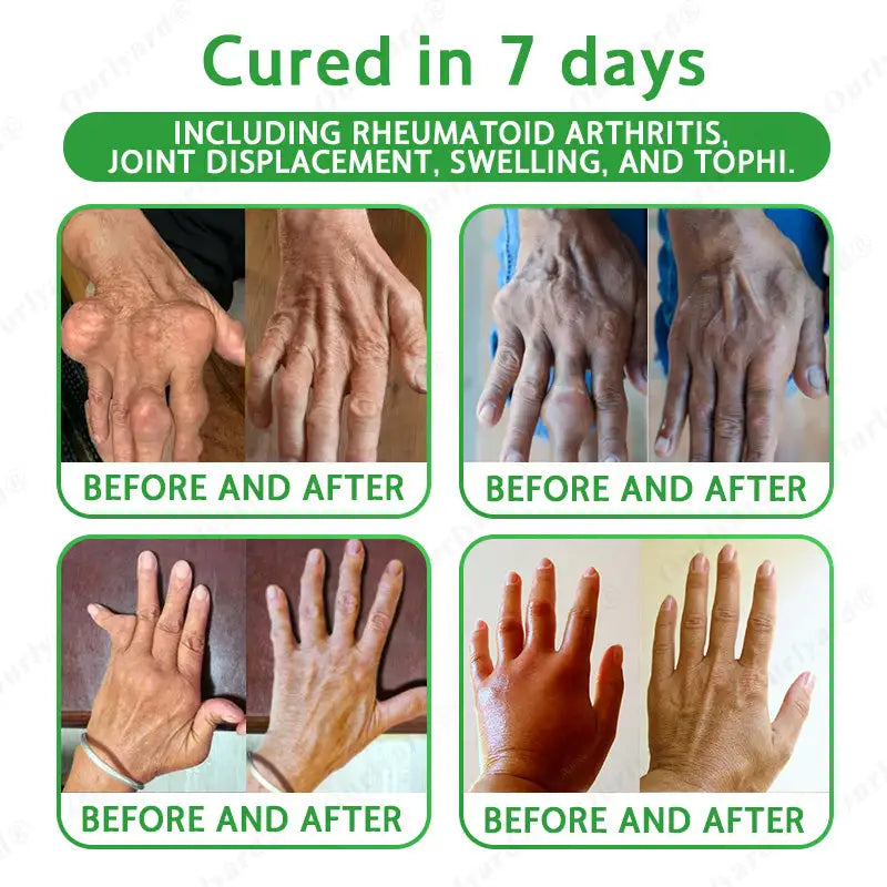 Ourlyard® Advanced Magnesium & Emu Oil Massage Pain Relief Gel
