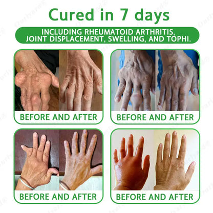 Ourlyard® Advanced Magnesium & Emu Oil Massage Pain Relief Gel