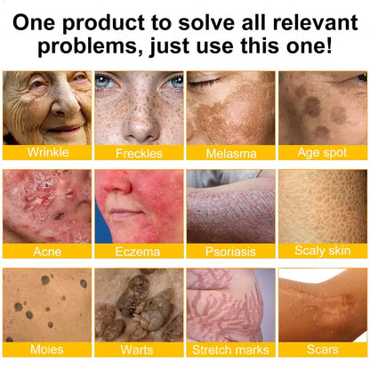 Ourlyard® Bee venom Comprehensive Cream