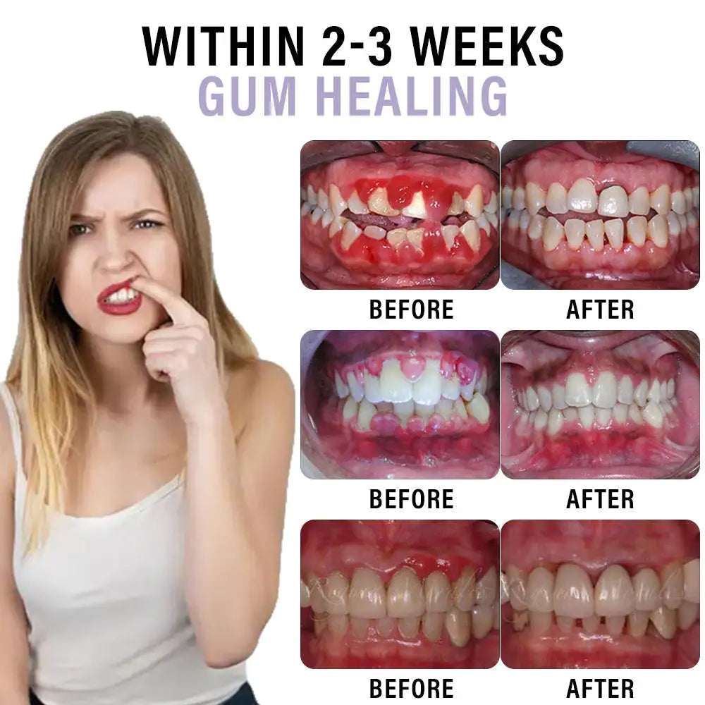 Ourlyard® Clove Oil Oral Care Spray