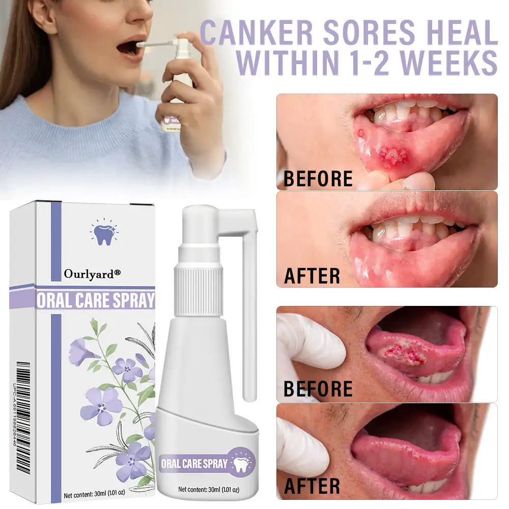 Ourlyard® Clove Oil Oral Care Spray