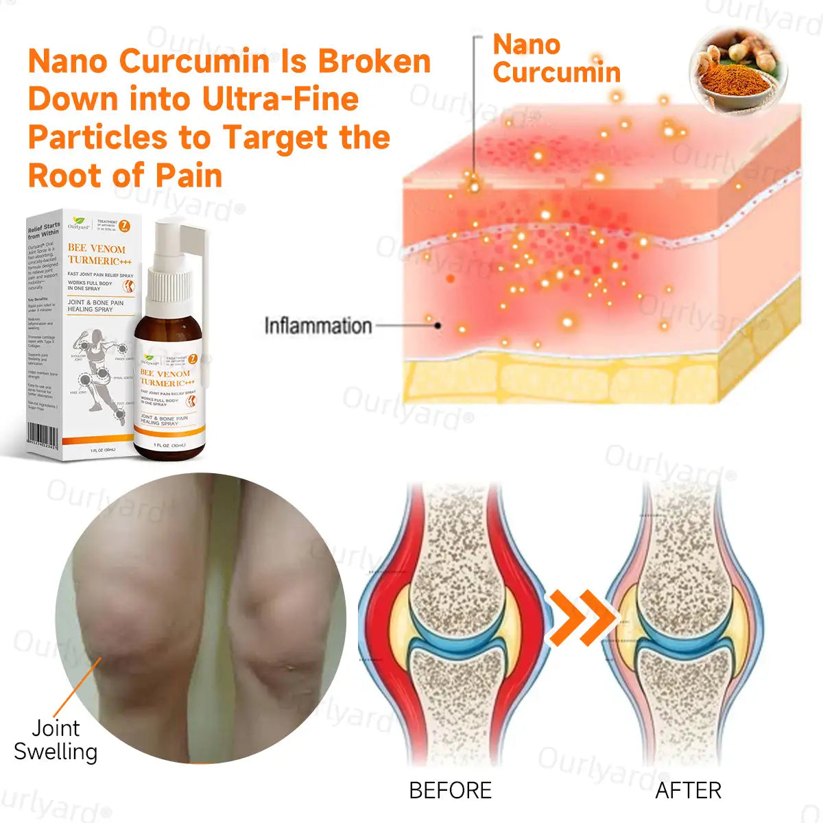 Ourlyard® Fast-Acting Bee Venom and Turmeric Joint & Bone Pain Healing Spray