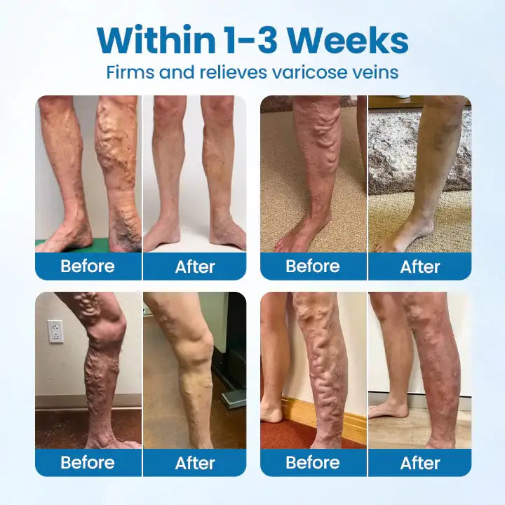 Ourlyard® Herbal Leg Spray