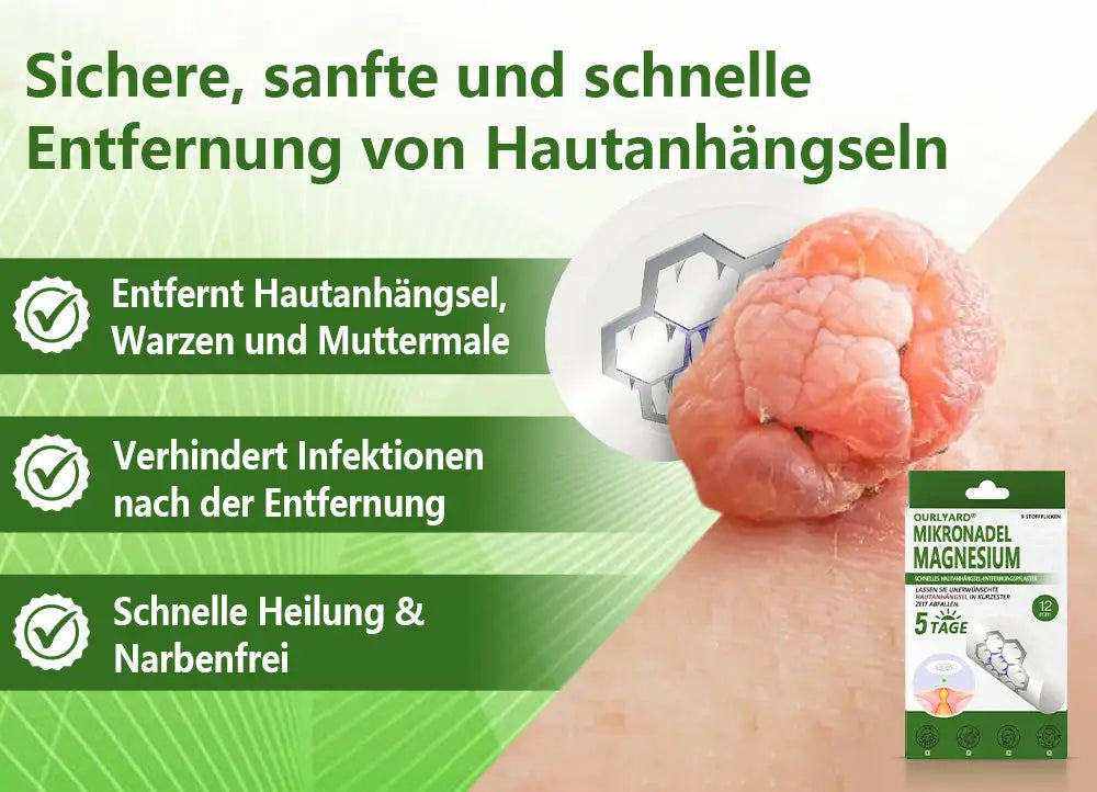 Ourlyard® Magnesium MicroNeedle Schnell Entfernen Hautmal-Pflaster