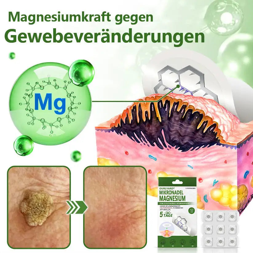 Ourlyard® Magnesium MicroNeedle Schnell Entfernen Hautmal-Pflaster