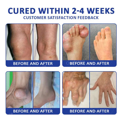 Ourlyard® Marine Sting & Emu Oil Arthritis Soothing Gel