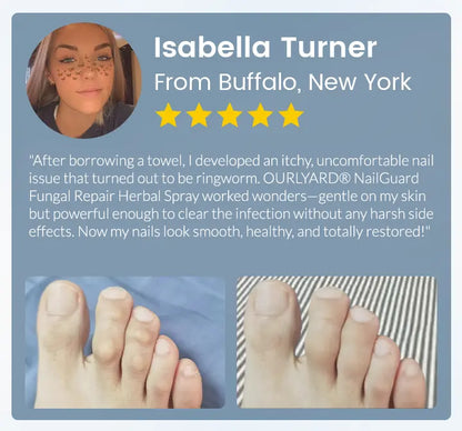 Ourlyard® NailGuard Fungal Repair Herbal Spray