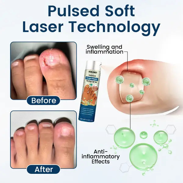 Ourlyard® NailGuard Fungal Repair Herbal Spray