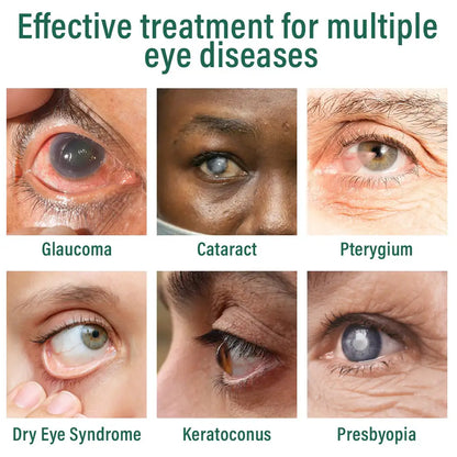 Ourlyard® Nano Eye Drops Serum