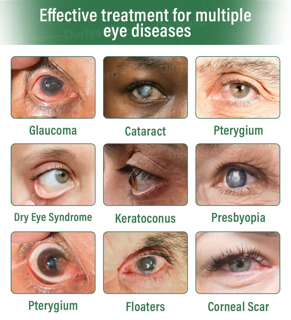 Ourlyard® OptiClear DualTech Eye Drops