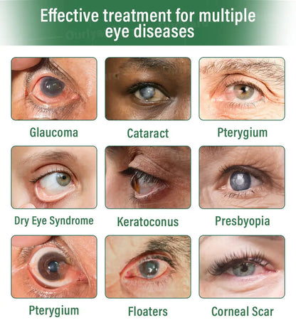 Ourlyard® OptiClear DualTech Eye Drops