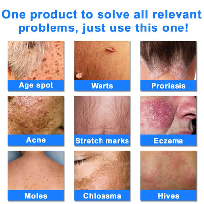 Ourlyard® Skin Treatment Cream
