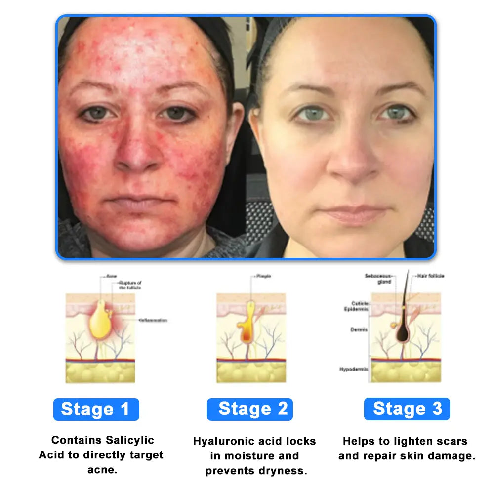 Ourlyard® Skin Treatment Cream