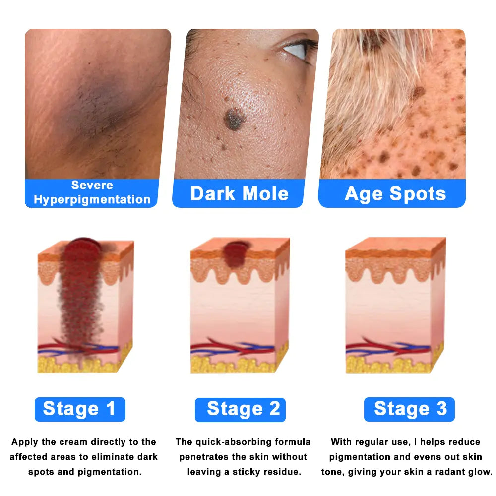 Ourlyard® Skin Treatment Cream