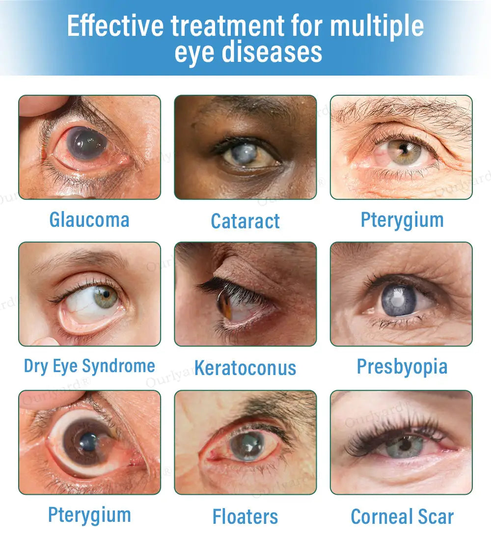 Ourlyard® Supramolecular Eye Drops