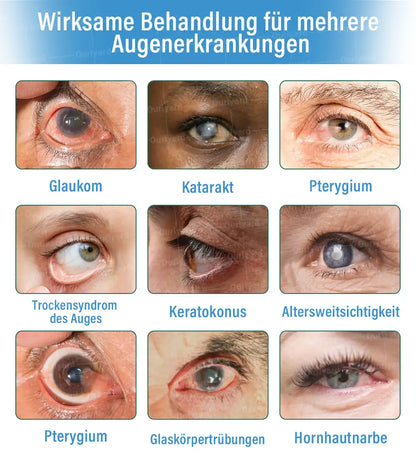 Ourlyard® Supramolekulare Augentropfen