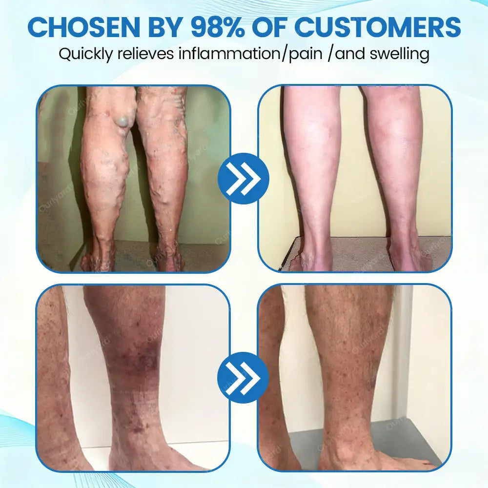 Ourlyard® VascuCare Vein Healing Spray