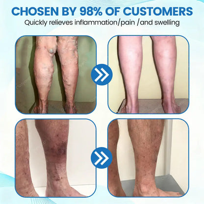 Ourlyard® VascuCare Vein Healing Spray