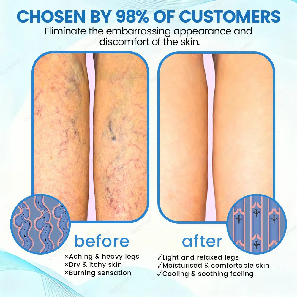 Ourlyard® VascuCare Vein Healing Spray