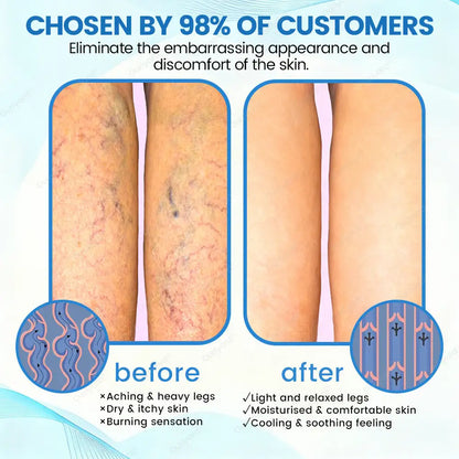 Ourlyard® VascuCare Vein Healing Spray