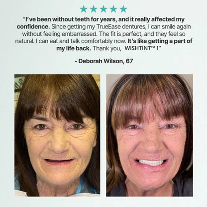 🌎Ends Today: 76% OFF! ⏰Wishtint™ Medical Full Denture with Strong Suctiond🦷